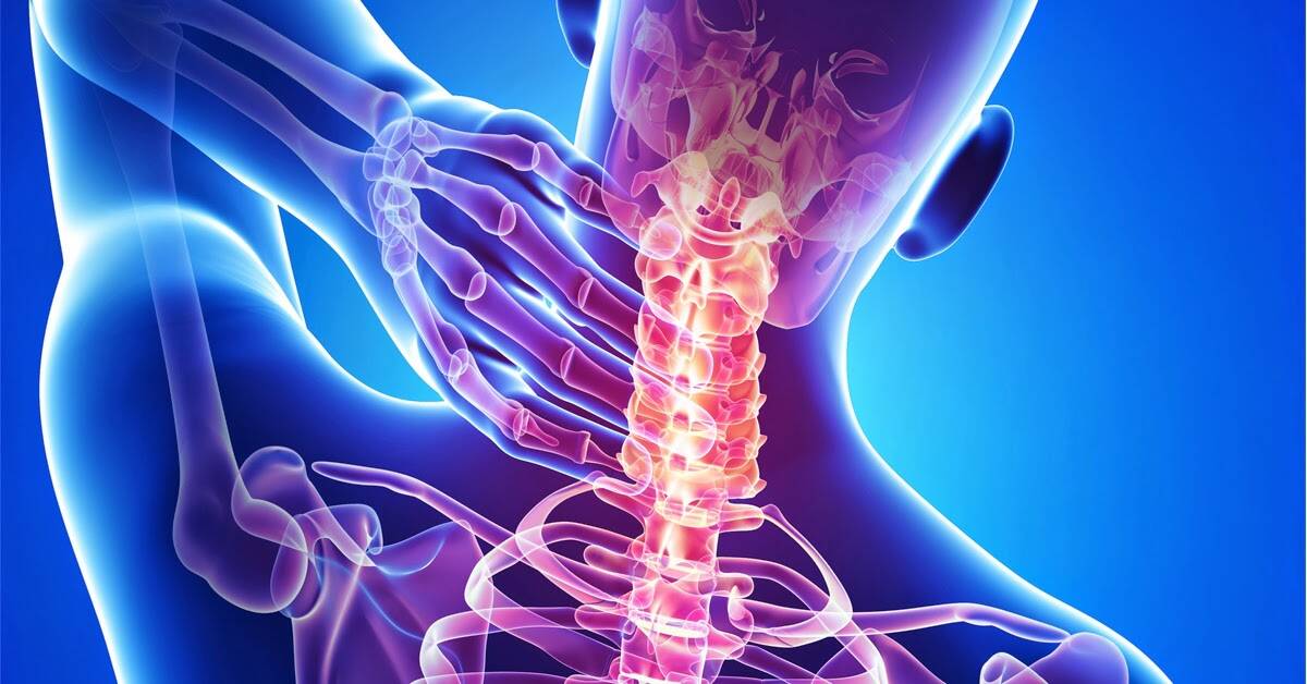 Cervicalgia curare il dolore al collo con trattamenti Osteopatici